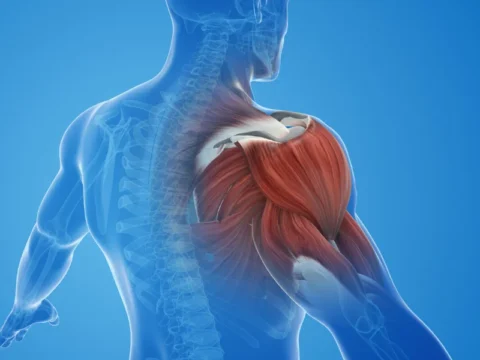 שרירים תפוסים